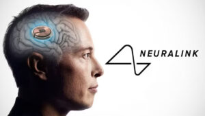 Neuralink Brain Implant Medical Device